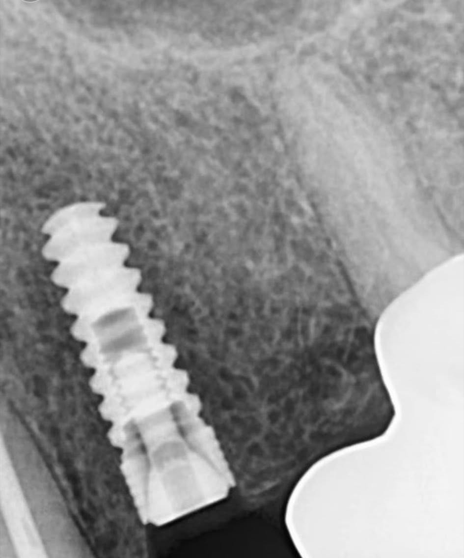 Clinical Case by د/ مالك علي