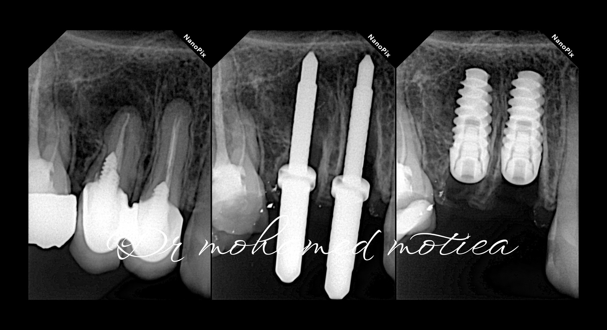 Clinical Case by د/ محمد مطيع